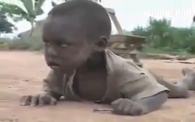 بالفيديو : المجاعة تقتل أطفال الصّومال أمام عيوننا 